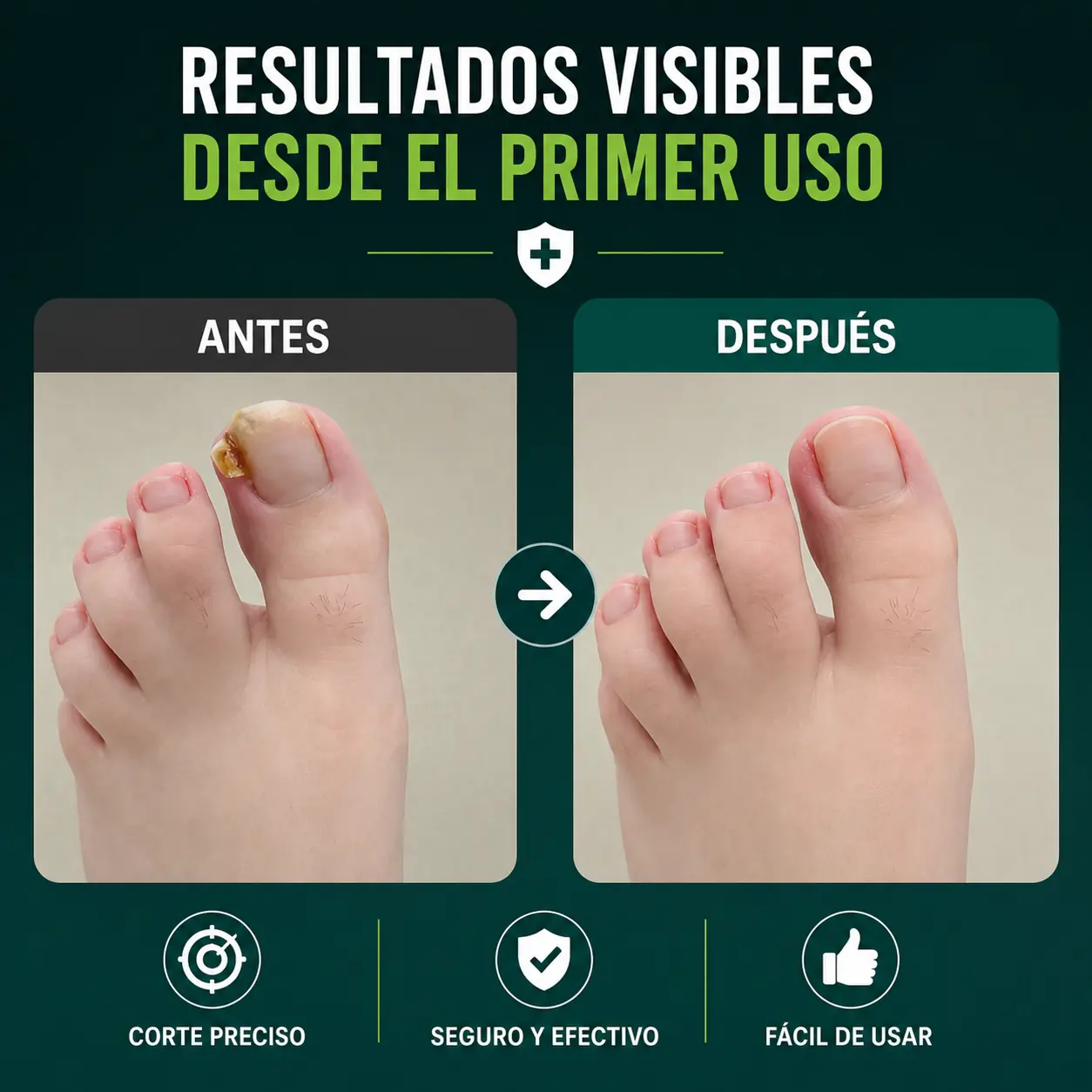 Cortauñas profesional grado médico